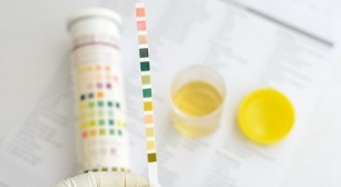 Puis-je fumer avant d'uriner pour analyse